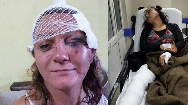 Sinem (Mersin) ve Oya Sultan (İstanbul) trabsfobik nefret saldırılarına uğradılar